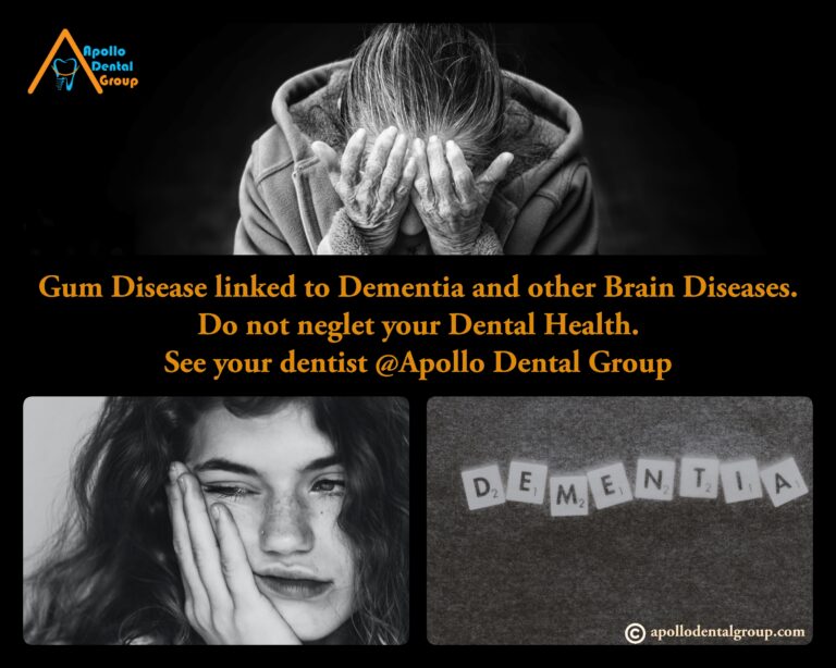 Gum disease & Dementia